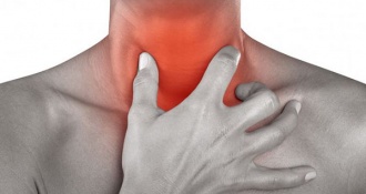 Viêm amidan cấp tính là gì? Triệu chứng và cách điều trị